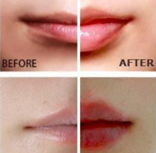 Miracle Lip Plumper – Instantly Fuller, Hydrated Lips